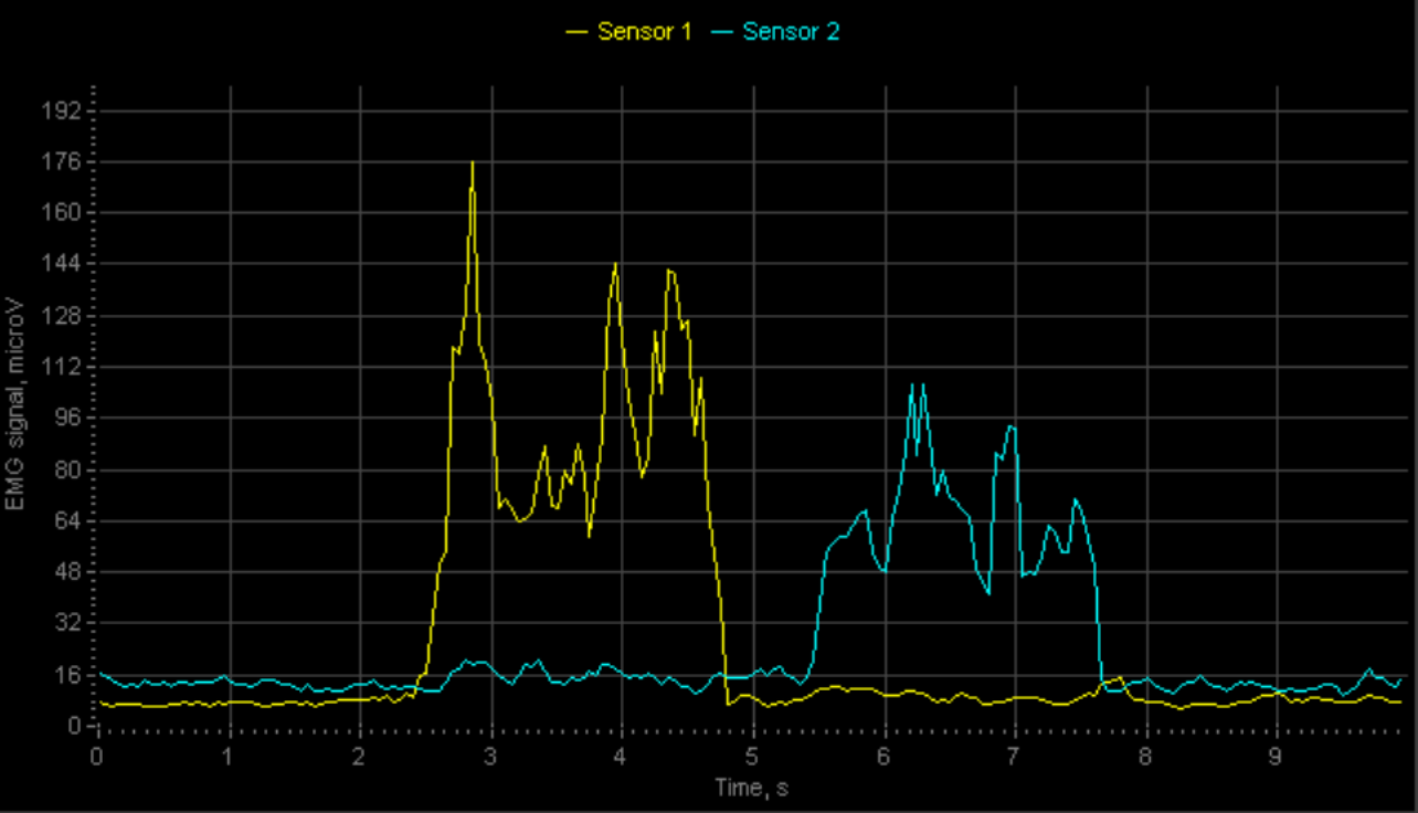График ЭМГ сигналов
